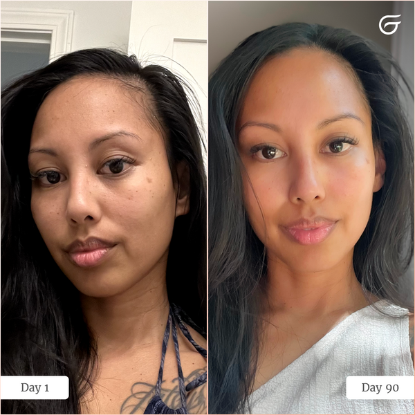 GlowUp™ LED Light Therapy Neck & Chest Mask